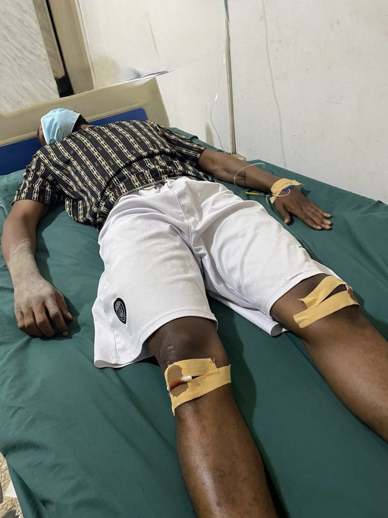 Patient lying on a hospital bed wearing a striped shirt and white shorts, with an IV in the left arm and taped bandages on both knees.